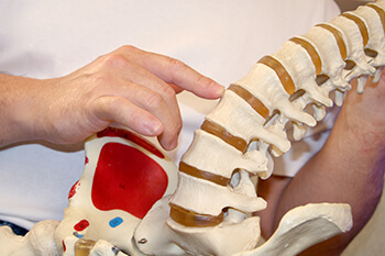 Subluxation Treatment Subluxation Treatment in the Boca Raton, FL 33432 area